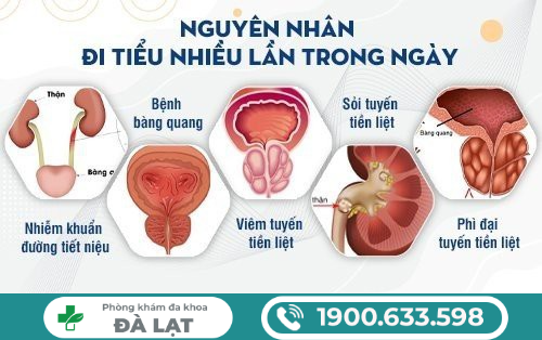 Hình ảnh minh họa
